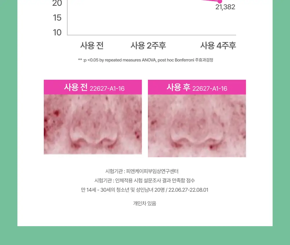 [0.1mm초슬림/최대용량] 이지덤 릴리프 스팟패치 69매 단독기획 / 짜기 전 티트리 여드름패치 상세페이지 15